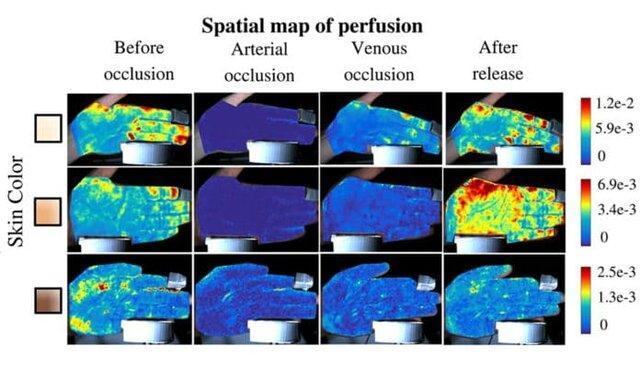 نقشه برداری از جریان خون زیر پوست با وضوح بالا