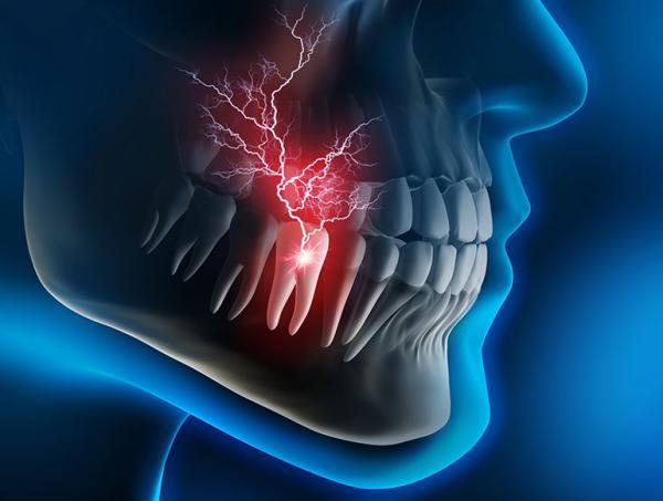 موارد دندانپزشکی اورژانسی و راهکارهای جلوگیری از آسیب های دندان